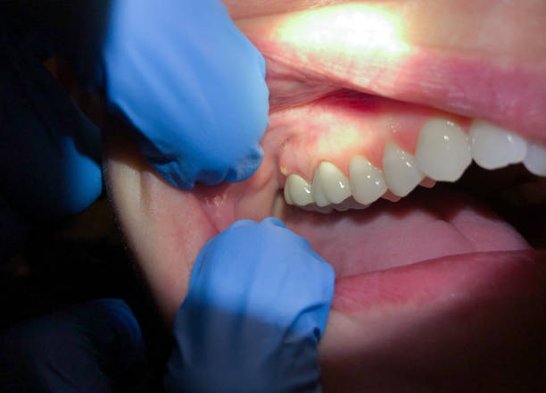 Best Dentist for Severe Toothache  in Ridgely, MD