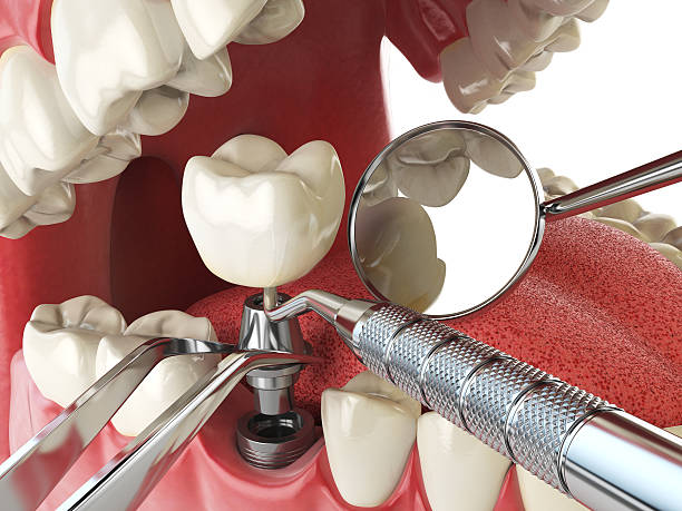 24-Hour Dental Clinic Near Me in MD